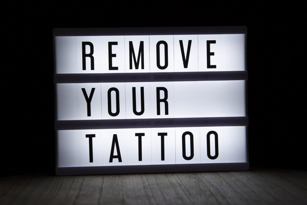 tattoo removal in dallas texas